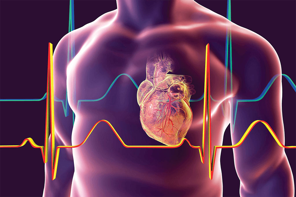 Cardiology in sama medical tourism