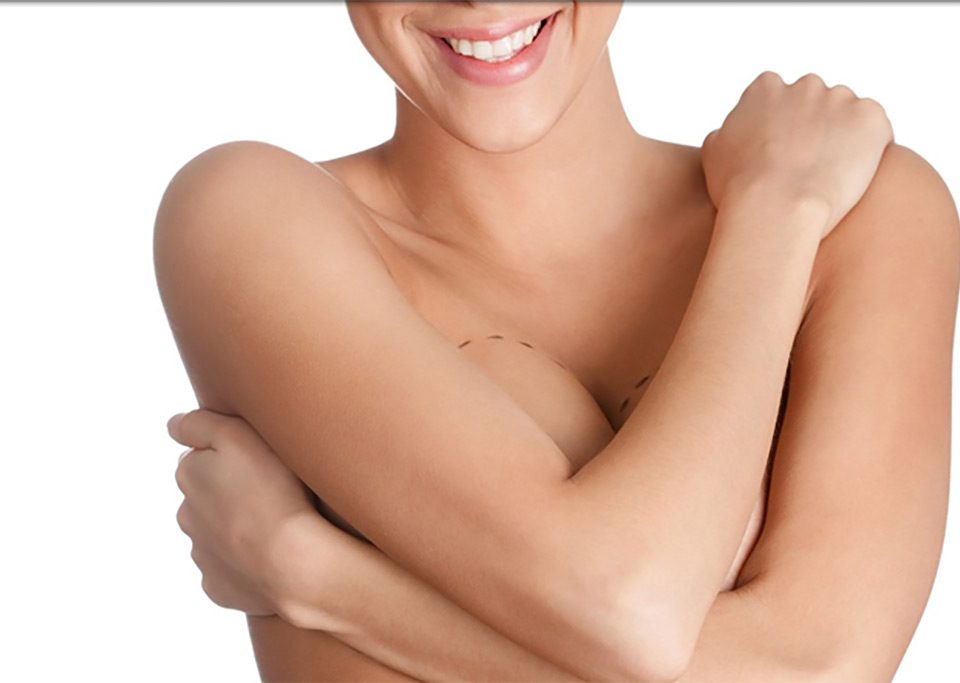 Mamoplasty in Iran | sama medical tourism