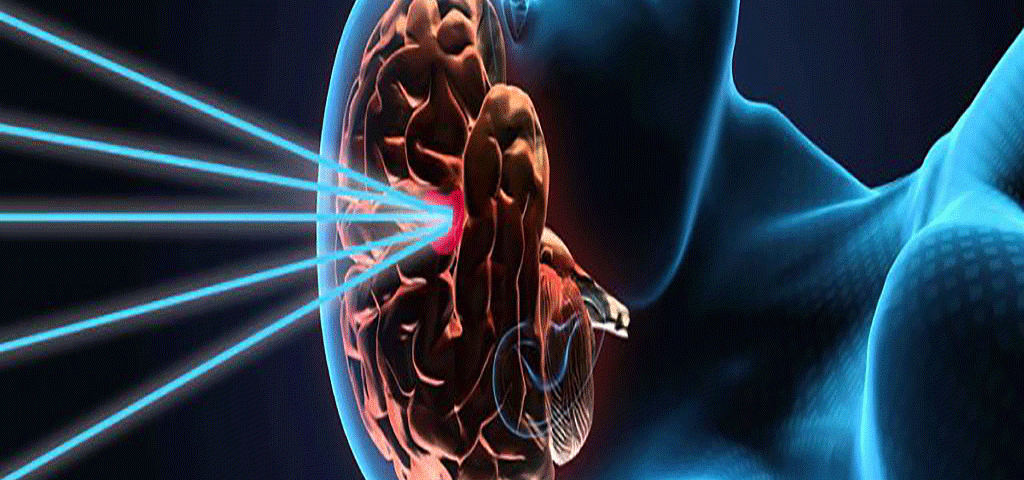 Neurosurgery,Brain surgery