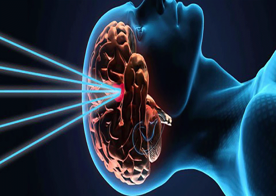 Neurosurgery,Brain surgery