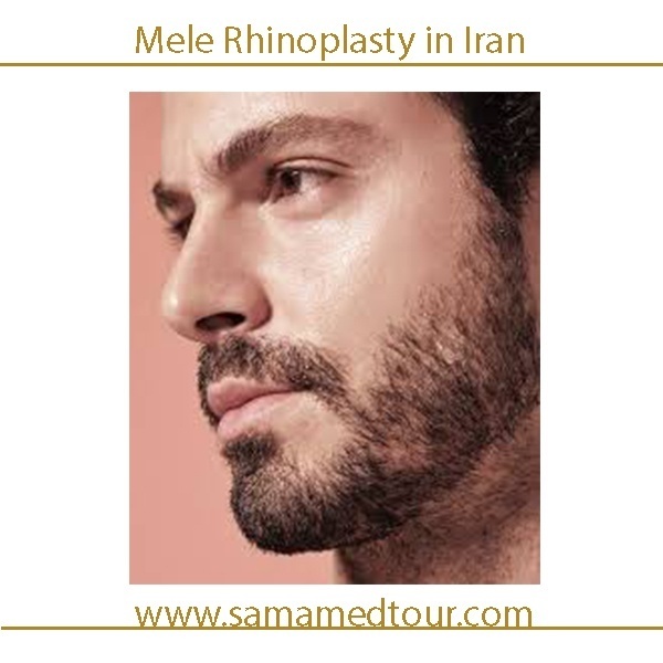 Men Rhinoplasty Gallery -Nose Surgery Before after photos