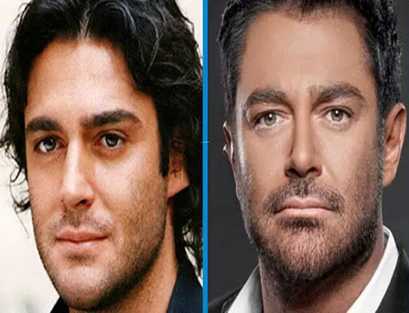 سما مد تور راینو پلاستی (2)